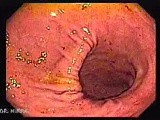 Perystalsis of Stomach • Video • MEDtube.net