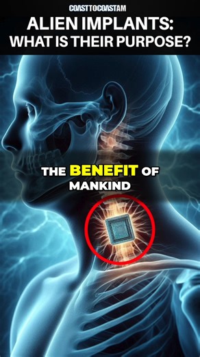 88K views · 1.5K reactions | Alien implants in abductees may serve a greater purpose, potentially benefiting mankind in unknown ways. #aliens #UFO #extraterrestrial | Coast to Coast AM | Facebook