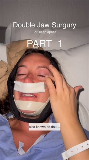 Dara Rhodes on Instagram: "Double Jaw Surgery aka MMA surgery was a gnarly one, but honestly the best thing I’ve ever done for my health. I had upper airway resistance syndrome and severe sleep apnea caused by my jaw not developing properly leaving my airways choked. As an adult the only way to truly fix this issue is moving bone which I did with an adult pallet expander, MSE device that separated my upper pallet, corticotomy surgery to further expand and lastly double jaw surgery to move everyt