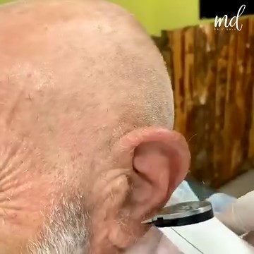 425K views · 910 reactions | Homeless man gets drastic transformation! | MetDaan Yummy | Facebook