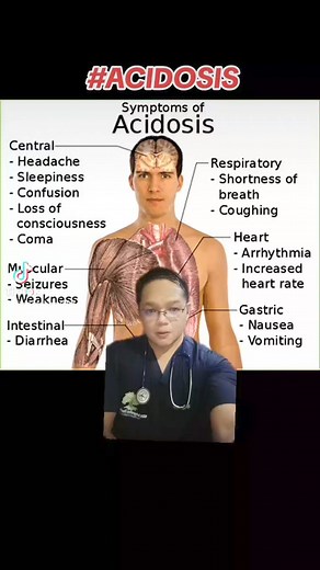 9.6K views · 101 reactions | ACIDOSIS Symptoms #acidosis #acidic #phlevels #headache #shortnessofbreath #arrhythmia #docROB | Robert Navalta | Facebook