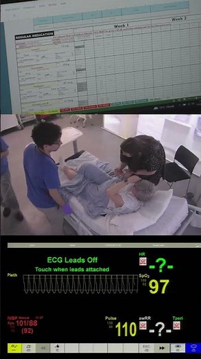 Acute Kidney Injury AKI Simulation