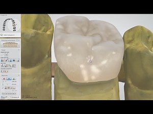 Smile Composer™ 2 0 with Integrated Sculpt Toolkit