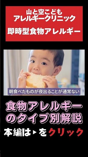 【食物アレルギーのタイプ別解説】タイプ1「即時型食物アレルギー」#アレルギー#食物アレルギー#小児