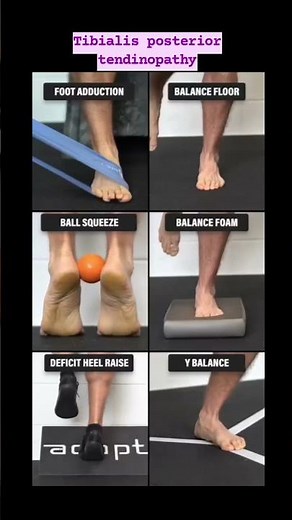 Tibialis Posterior tendinopathy #vital #youtube