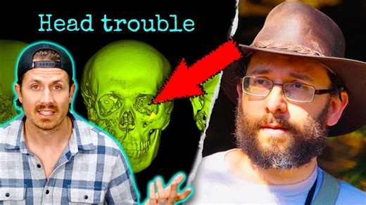 His skull was melting... and no one knew why
