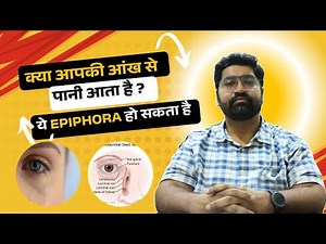 Video-5 Epiphora: Meaning, Symptoms, and Treatment