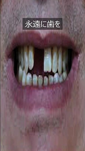 First aid for when your teeth fall out (if you want to avoid losing your teeth for the rest of yo...
