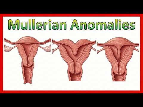 Müllerian Anomalies 🧬 | Uterine Development & Classification | USMLE NEET-PG