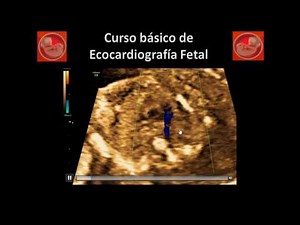 Plano del Arco Ductal: Tips para su obtención