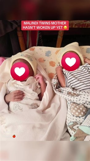Huyu anaitwa halima kutoka malindi alizaa na operation Katika hospital ya malindi mnamo 27th February last mnth Ali bahatika kupata mwa twins🤲 ila tangu afanyiwe hiyo CS hawajai kumuamka hadi sasa😢 sahi yuko kilifi hospital Familia wanaomba support ya maziwa,pampers na madawa Mamayao yupo kwa life supporting machine wana hitaji ata Japo maombi ili mama amke aone watoto wake jamani 🙏 Malelezo kamili kutoka kwa inbox yangu 👇 Tunaye msichana moja Kwa jina maalum ni HALIMA KORE.. Halima alijaliw