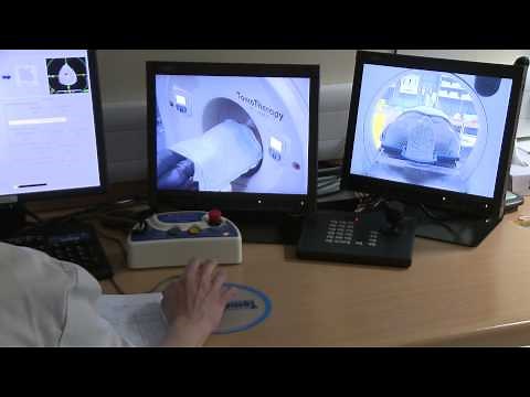 Having radiotherapy for head and neck cancer