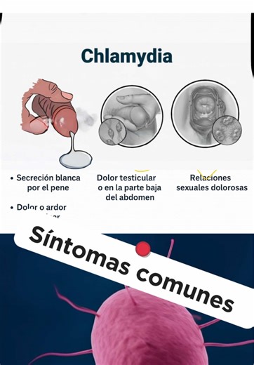 Síntomas de clamidia: ¿Qué debes saber?