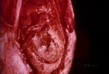 Inside human ear, eardrum, and ear bones | Britannica