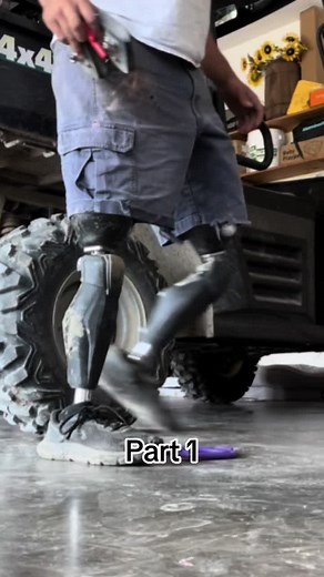 Understanding How Battery Powered Prosthetic Legs Work