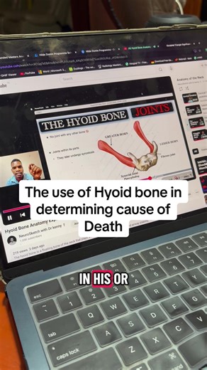 Understanding the Hyoid Bone and Cause of Death
