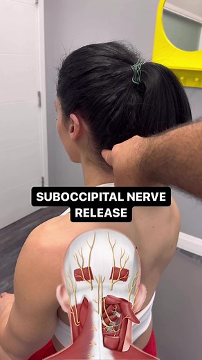 Relieve Suboccipital Nerve Pain with Targeted Exercises