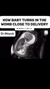 Watch how a baby turns in the womb during pregnancy #baby | Dr.Moyub Healthcare