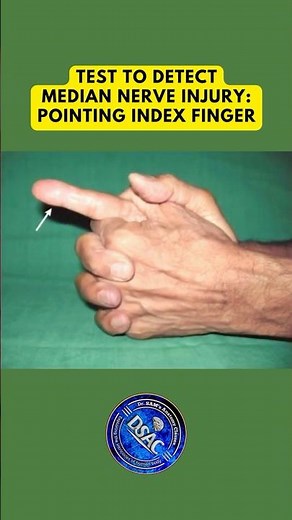 How to check if its a pointing index finger deformity? Clinical anatomy of median nerve #shorts