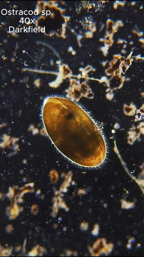 Flatworm on the Frontier! #microworlds #biology #science #microbiology #microscopy #microscope #new