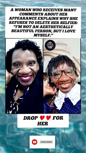 I’m Not Beautiful” — Her Powerful Self-Love Message Is Inspiring Millions ❤️ #love #beauty #fyp