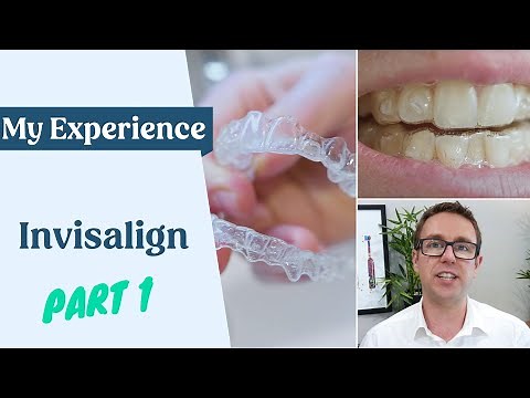 My Invisalign Experience - Things To Know - First Week