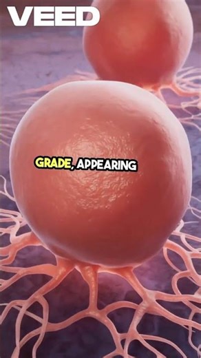 The Key Of Cancer Gradings #grades - Understanding Cancers