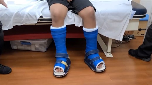 【vlog】Serial Casting for Toe Walking