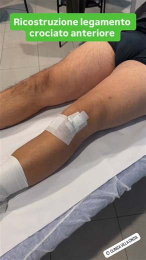 💪 Ci sono recuperi che vanno oltre l’intervento. Il percorso di 𝗚𝗲𝗿𝗮𝗿𝗱𝗼 ci ricorda una cosa semplice ma potentissima: la guarigione non è mai il risultato di un solo gesto, ma di un incontro. L’incontro con un 𝗽𝗮𝘇𝗶𝗲𝗻𝘁𝗲 che non molla, che accetta la fatica, che ci crede anche nei giorni difficili. L’incontro con un 𝗰𝗵𝗶𝗿𝘂𝗿𝗴𝗼, 𝗔𝗻𝗱𝗿𝗲𝗮, che lavora con competenza e rispetto. L’incontro con un 𝗳𝗶𝘀𝗶𝗼𝘁𝗲𝗿𝗮𝗽𝗶𝘀𝘁𝗮, 𝗙𝗿𝗮𝗻𝗰𝗲𝘀𝗰𝗼, che accompagna, sprona, sostie