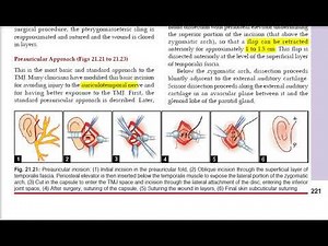 surgical approaches to mandible condyle and its neck TMJ part2