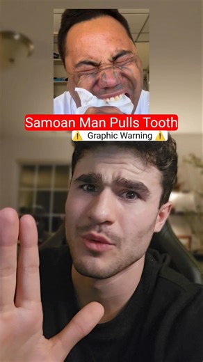 Is Dental Coverage THAT High!? #shorts #commentary #reaction