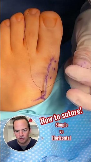 How to put in stitches! 🤯