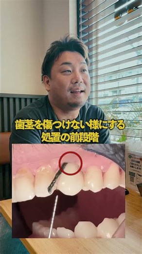 A dentist explains the true nature of the "thread" used in dental treatment! [Dentist]