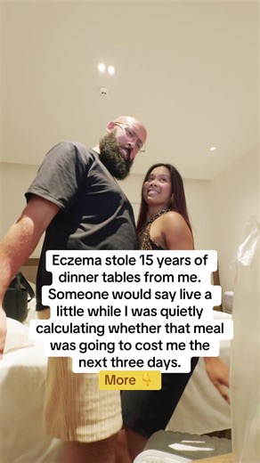 I want to talk about something nobody in any appointment ever addressed. The anxiety. Not the skin. Not the mechanism. Not the biology. The specific kind of anxiety that comes from living inside a body you cannot trust. The kind that does not show up on any medical chart and does not get a prescription and does not get acknowledged by any specialist who has ever looked at your hands and seen a dermatological condition requiring a dermatological solution. Live a little. I heard that more times th