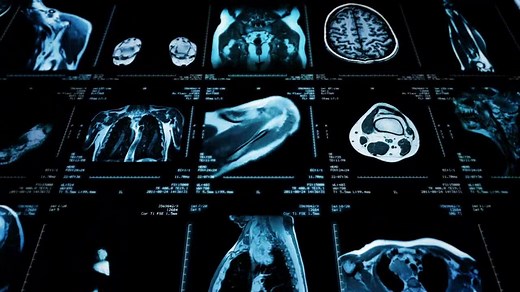 Open MRI | Birmingham Physicians Imaging | Southern Radiology Specialists | Southern Radiology Specialists Birmingham, AL