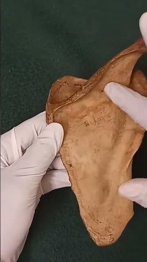 Muscle attachments of scapula