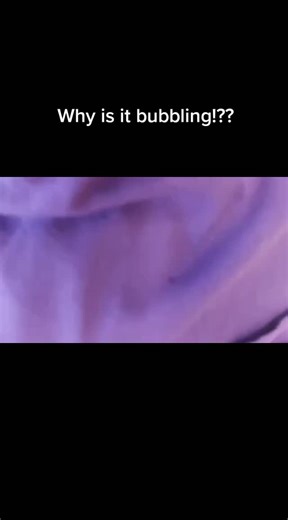 Understanding Bubbling Noises in Your Stomach