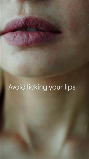 Best Remedies for Chapped Lips 👄✨ #shorts