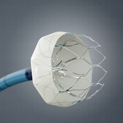 15M views · 77K shares | This expanding implant could cut the risk of strokes. | Insider Tech | Facebook