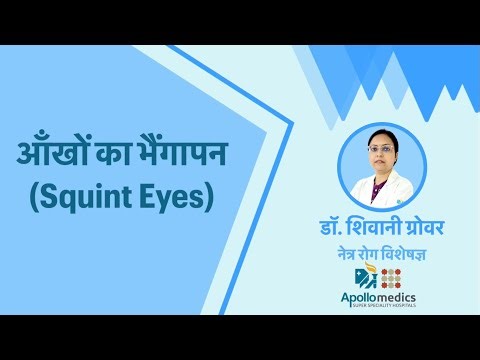 What are Squint Eyes ? Causes & Treatment Explained by Dr Shivani Grover | Apollo Hospital Lucknow
