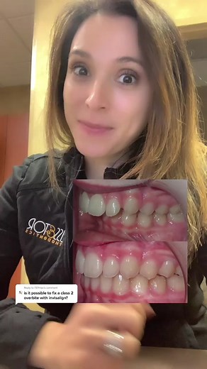 Overbite Correction: Tips from Orthodontic Experts