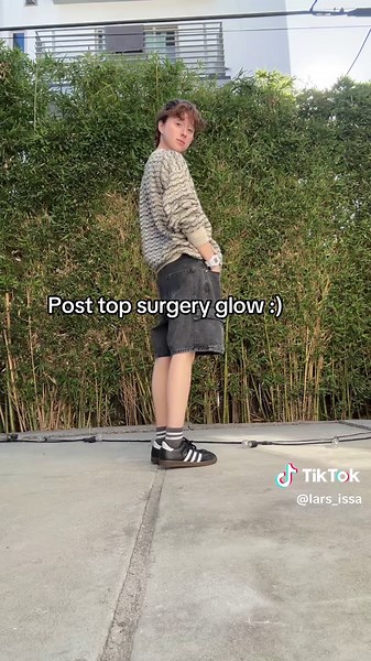7 Weeks After Top Surgery: Post-Op Reflections