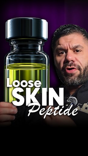 Loose skin after weight loss - is there ANYTHING you can do? Here's what you might want to consider before undergoing surgery. Disclaimer: I do NOT encourage the use of steroids or other illegal substances. Always consult a medical professional before considering any enhancement protocol. | Afser Choudry