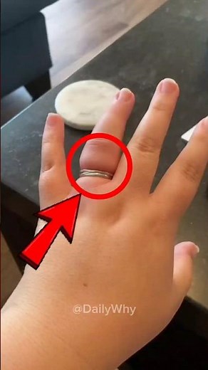 Ring stuck on your finger? Try this weird trick 😳💍