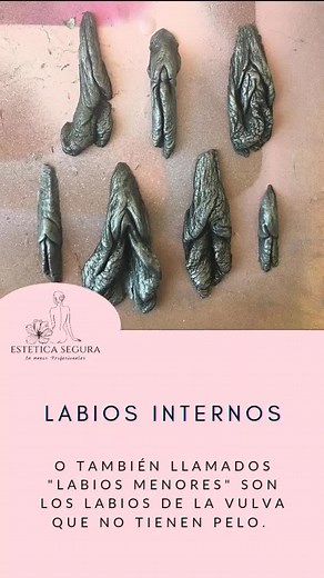 Todo sobre la Labioplastia y Cirugía Vaginal