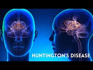 HUNTINGTONS DX or Disease; mutation in the HTT gene, Symptoms, Treatment