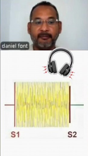 Insuficiencia Mitral 🎧SOPLO |Galileo Médico #drdanielcardiologo #medicina #doctor #shorts