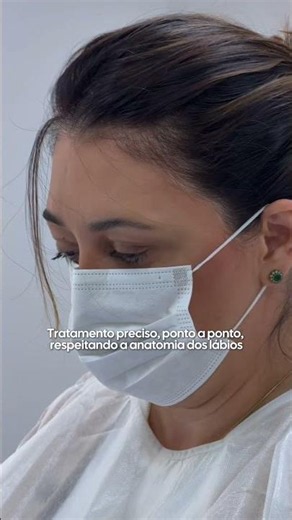 Discover the LVB microsurgery for Fordyce spots | Dr. Luciana Villas Bôas