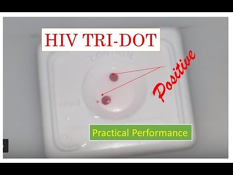HIV Rapid antibody test-Reactive| HIV tridot Positive| HIV blood test Positive