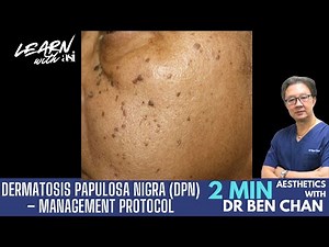Dermatosis Papulosa Nigra (DPN) – Management Protocol